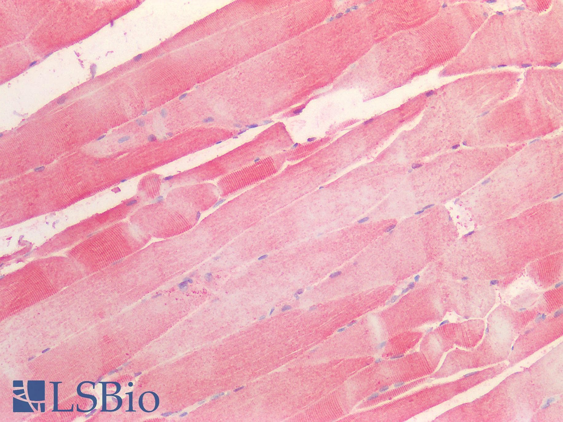 Polyclonal Rabbit anti-Human LOXL1 Antibody (aa369-574, IHC, WB)