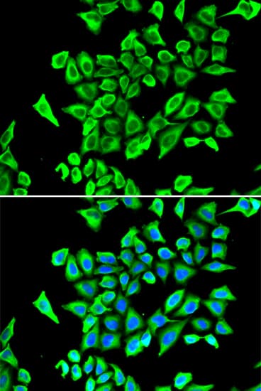 PathPlus™ Polyclonal Rabbit anti-Human LCN2 / Lipocalin 2 / NGAL Antibody (IHC, IF, WB)