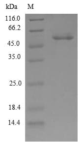 Human NAR / CPSF4 Protein (Recombinant GST, N-terminus)