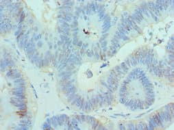 CBX8 Antibody (aa80-280)