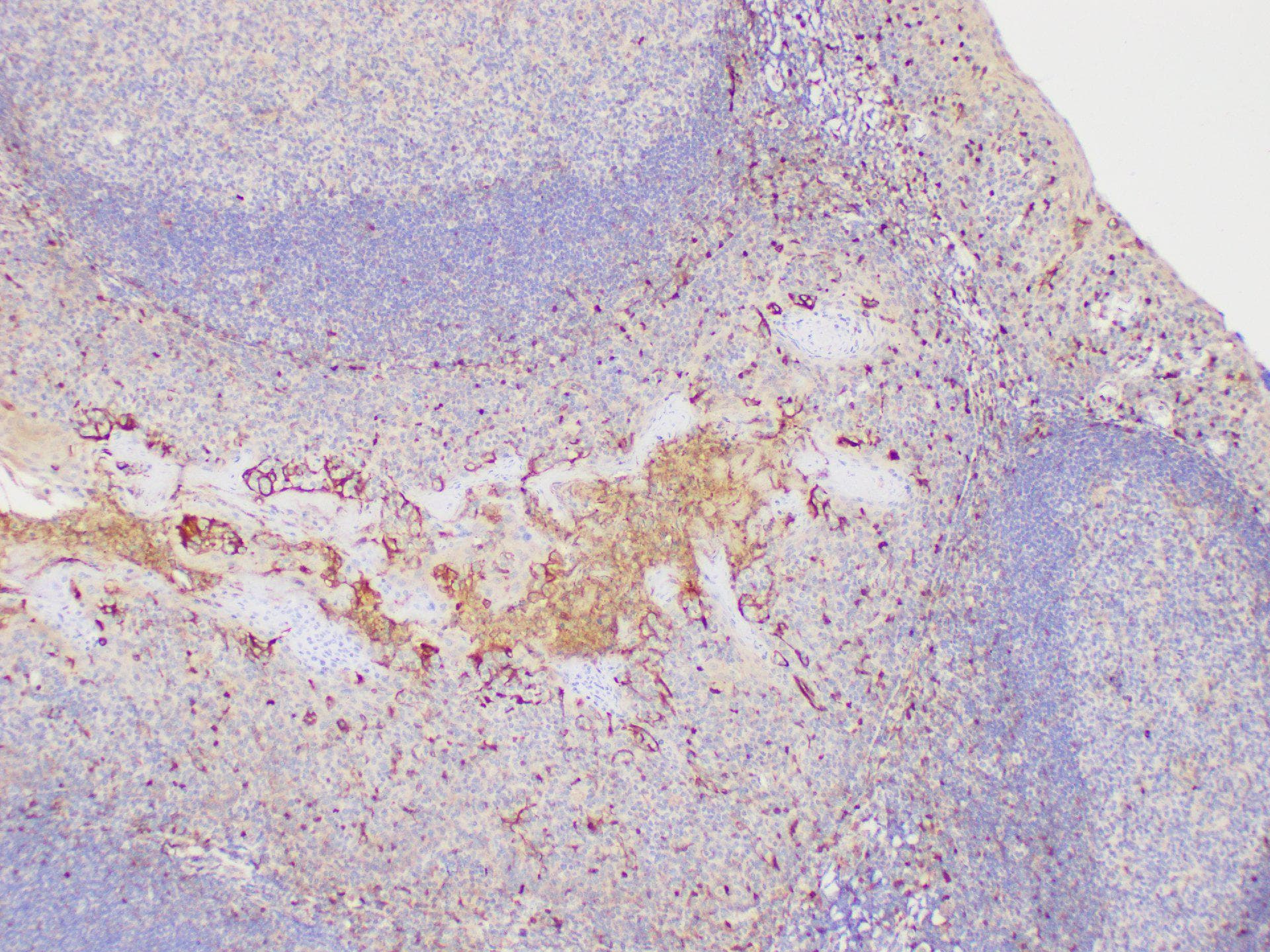 S100A4 / FSP1 Antibody