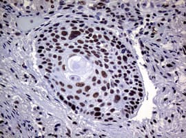 NBN / Nibrin Antibody (clone OTI9H2)