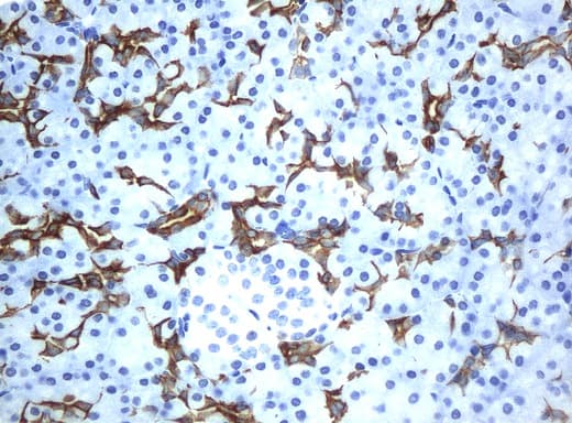 KRT19 / CK19 / Cytokeratin 19 Antibody (aa240-390, clone UMAB2)
