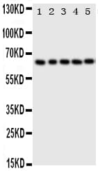 TP63 / p63 Antibody (aa664-680)