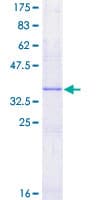 Human CGA / hCG Alpha Protein (Recombinant GST)