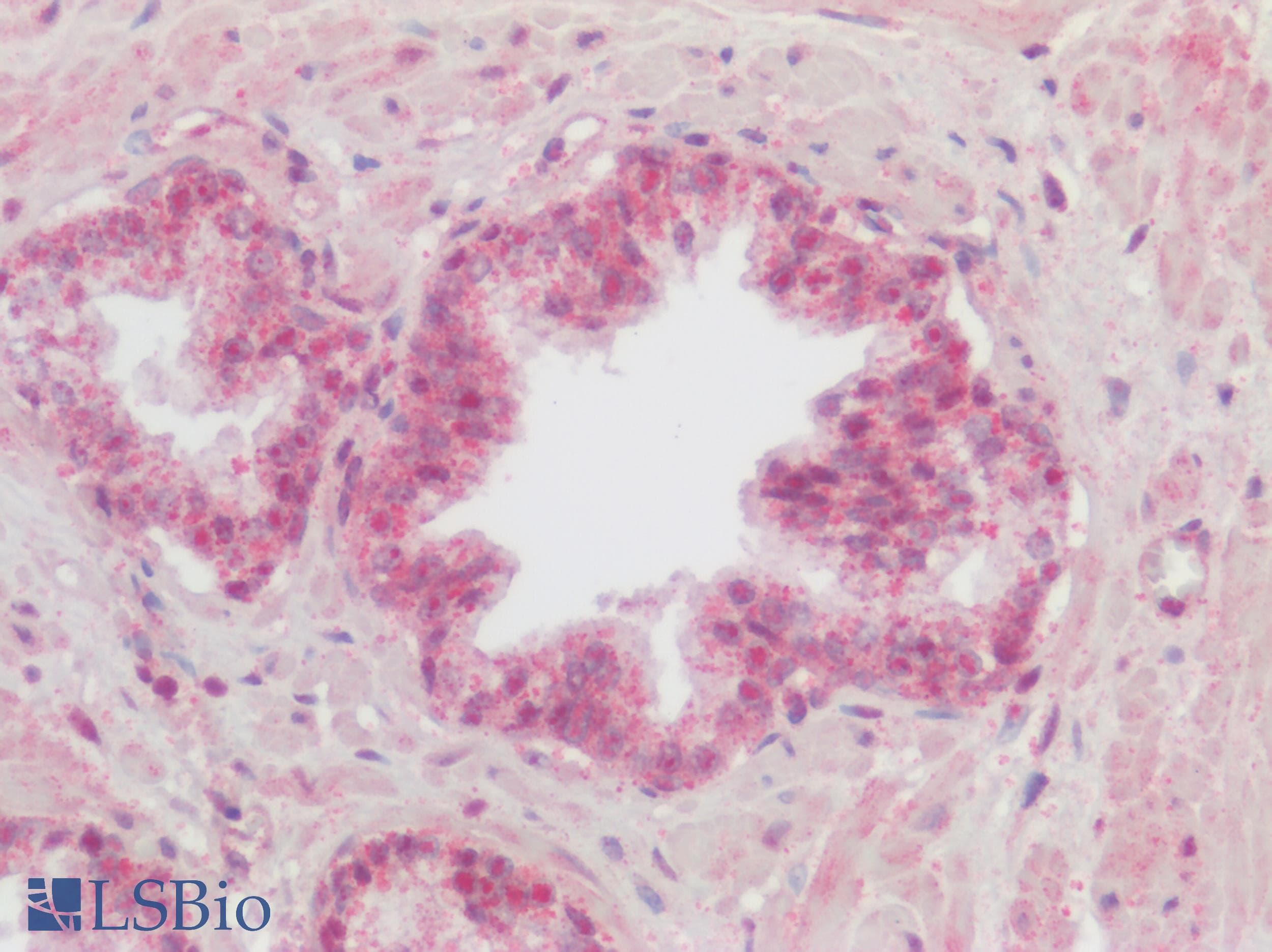 PathPlus™ CHRM3 / M3 Antibody (C-Terminus)