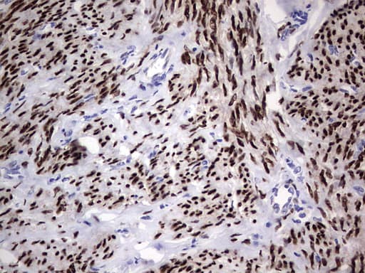 PR / Progesterone Receptor Antibody (aa1-298, clone OTI2C2)