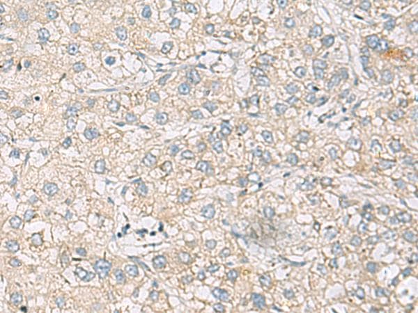 Polyclonal Rabbit anti-Human RAC2 Antibody (IHC)