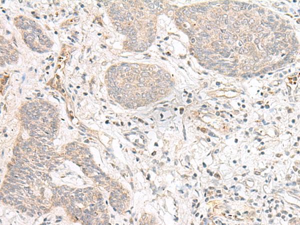 FBXW8 Antibody
