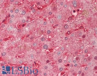 PathPlus™ SEMA3A / Semaphorin 3A Antibody (aa31-141)