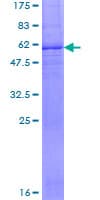 Human SLC25A15 / ORNT1 Protein (Recombinant GST)