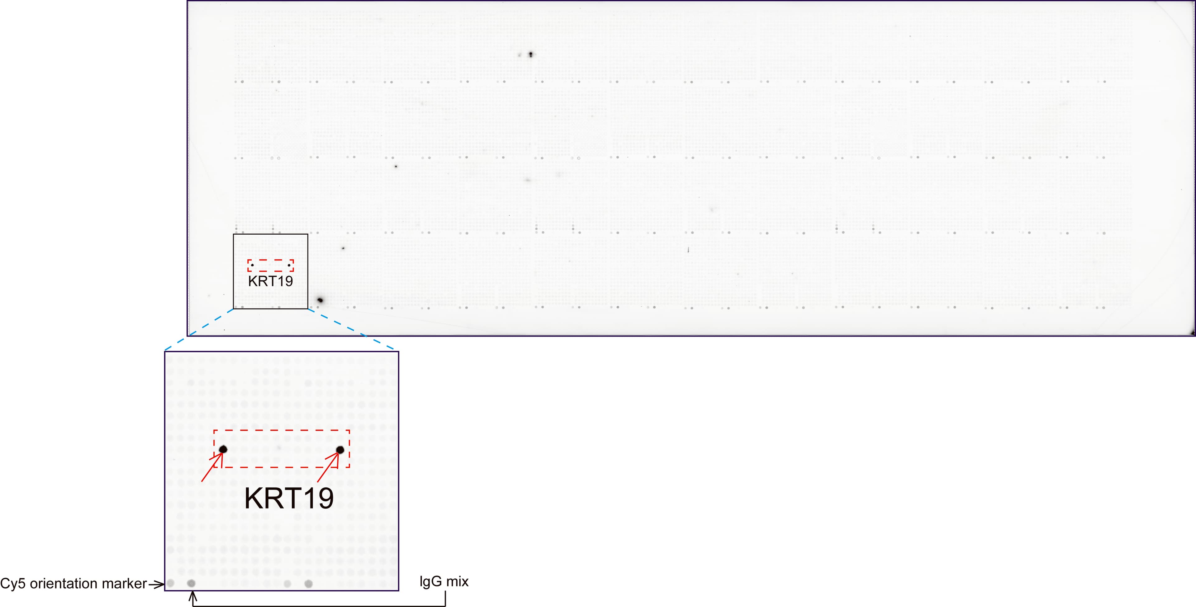 KRT19 / CK19 / Cytokeratin 19 Antibody (aa240-390, clone UMAB186, Carrier-free)