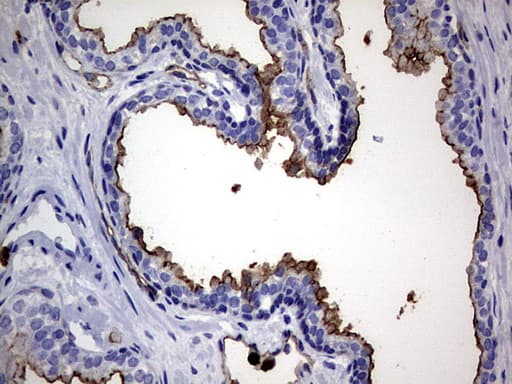 CEACAM5 / CD66e Antibody (aa35-680, clone OTI1C2)