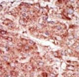 HK3 / Hexokinase 3 Antibody (aa760-789)
