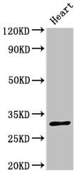 NRIP2 Antibody
