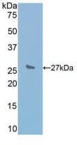 Mouse IL2RB / CD122 Protein (Recombinant His, N-Terminal)