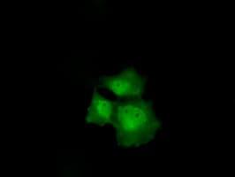 Monoclonal Mouse anti-Human p16INK4a / CDKN2A Antibody (clone OTI4C11, IF, WB)
