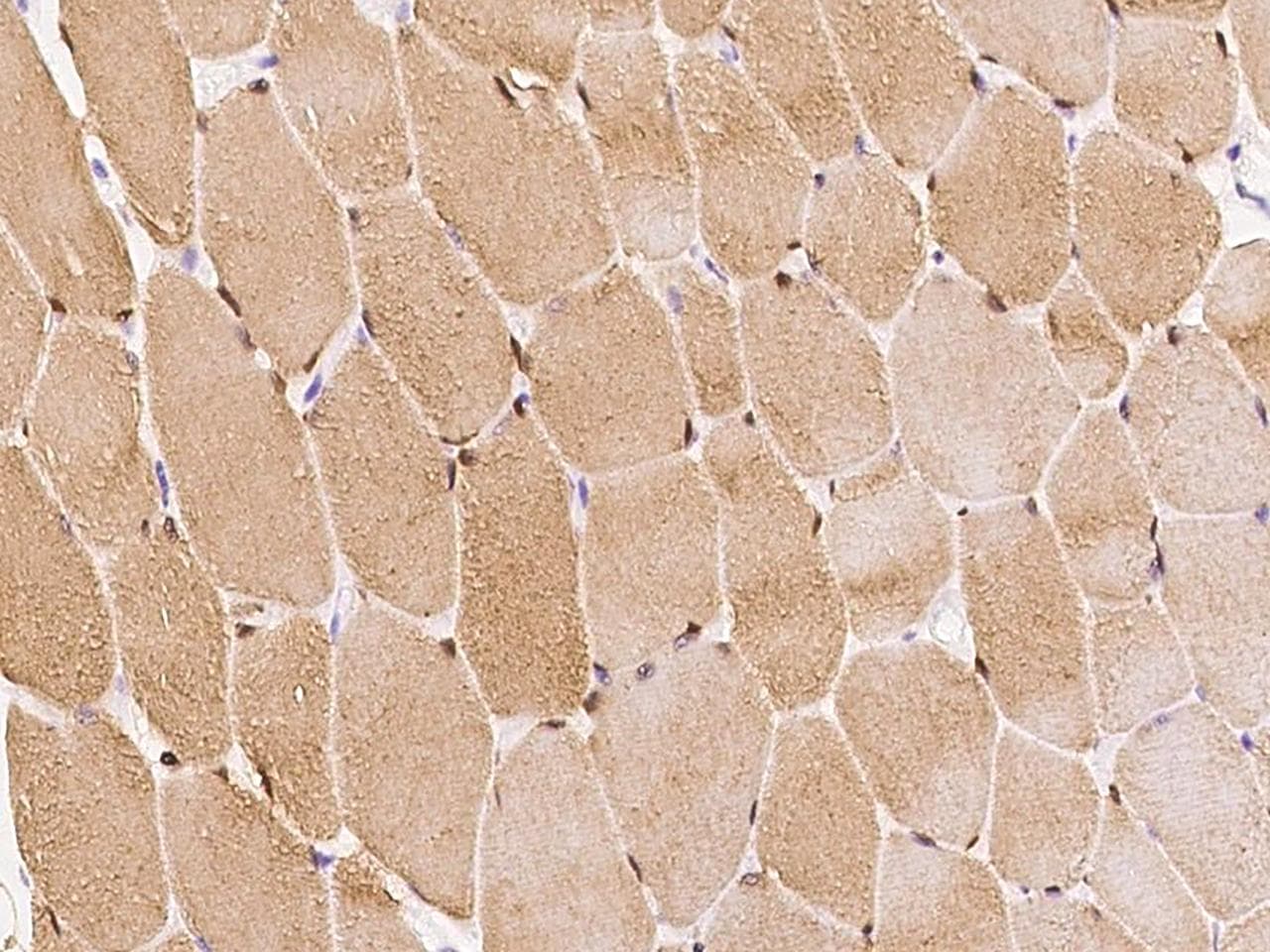 Polyclonal Rabbit anti-Human SMYD1 Antibody (IHC)