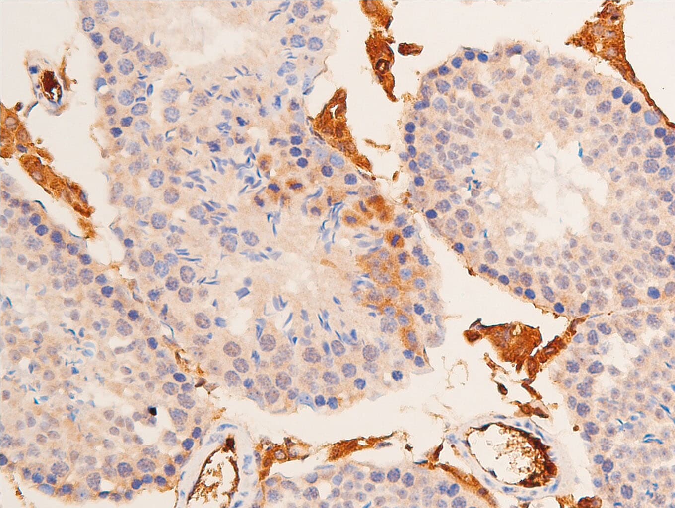 TP53 / p53 Antibody (Acetyl-Lys317)