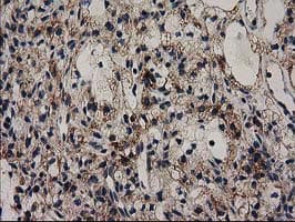 GRHPR / Glyoxylate Reductase Antibody (clone OTI1A9, Carrier-free)