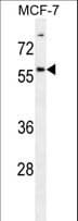 ZNF165 Antibody (aa215-242)