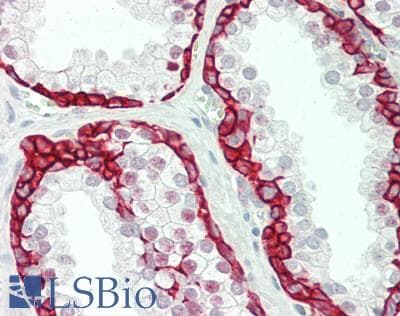 PathPlus™ KRT5 / CK5 / Cytokeratin 5 Antibody (510-590 aa, C-terminal)