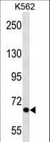 CARF / ALS2CR8 Antibody (aa132-158)
