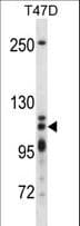 XRN2 Antibody (aa48-76)