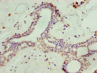 Polyclonal Rabbit anti-Human SOST / Sclerostin Antibody (aa24-213, IHC)