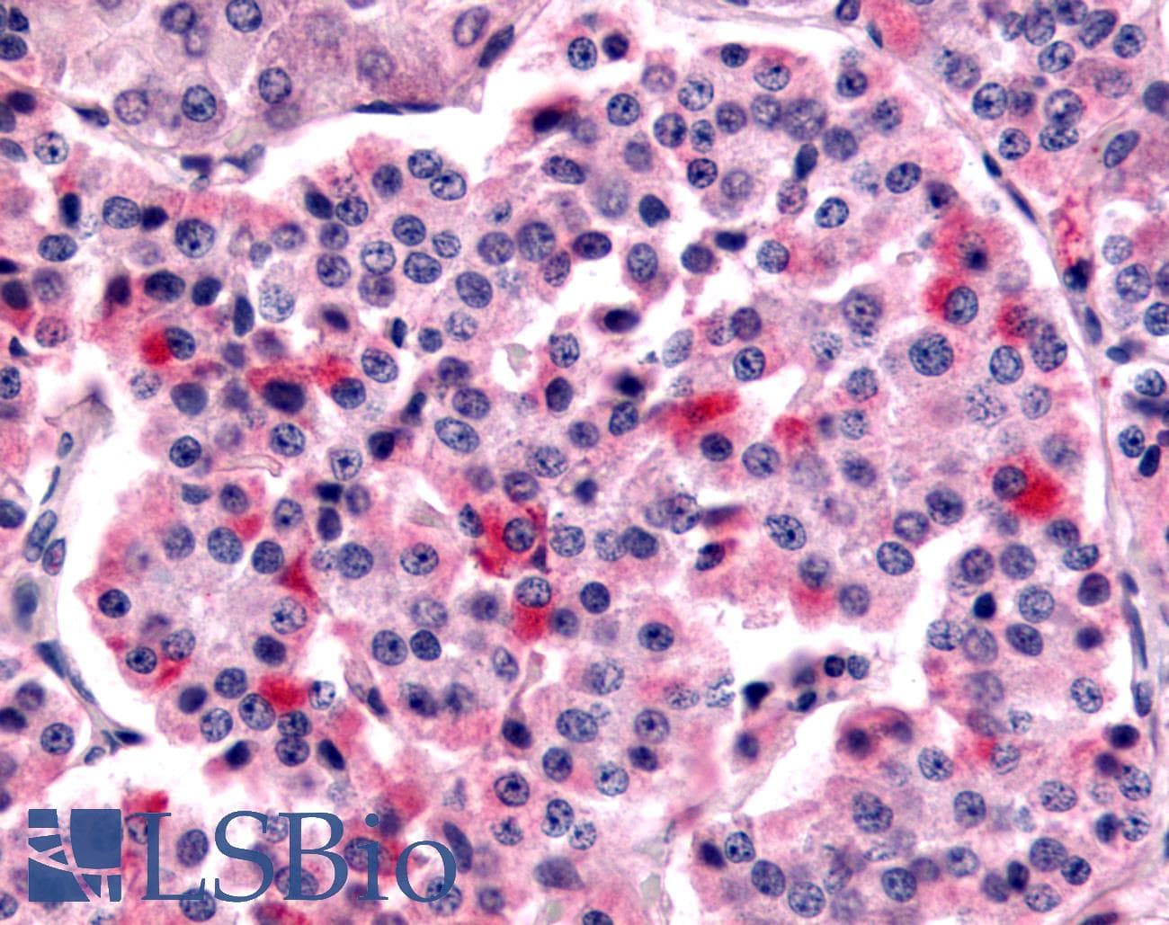 IHC-plus™ FZD5 / Frizzled 5 Antibody (N-Terminus)