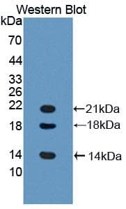 LYAR Antibody (aa270-388, FITC)