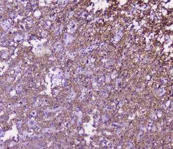 Polyclonal Rabbit anti-Human SNAP25 Antibody (IHC, WB)