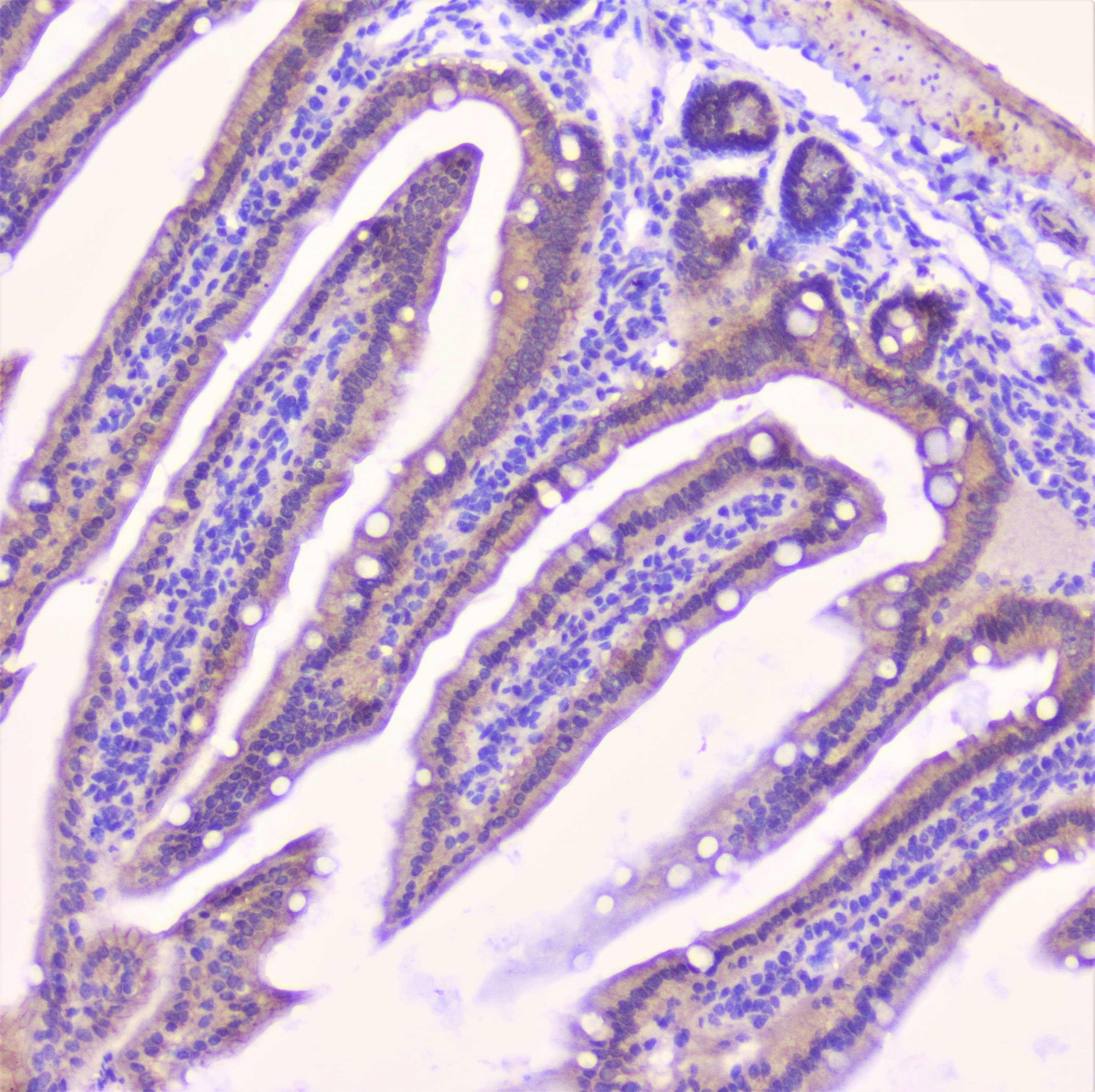 CDH3 / P-Cadherin Antibody