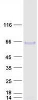 Human ARSB / Arylsulfatase B Protein (Recombinant Myc-DDK (Flag))