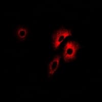 IHC-plus™ PCCB Antibody