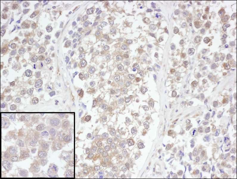 UCHL3 Antibody (aa174-224)