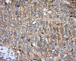 BTK Antibody (clone OTI3A2)