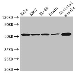 Polyclonal Rabbit anti-Human ZBTB43 Antibody (IHC)