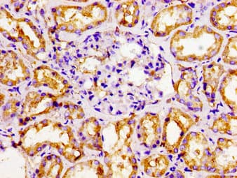 EAR2 / NR2F6 Antibody