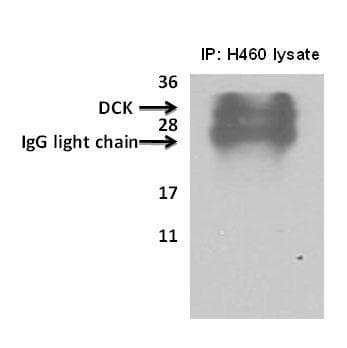 DCK / Deoxycytidine kinase Antibody (aa171-200)