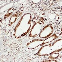 Polyclonal Rabbit anti-Human MAPK6 / ERK3 Antibody (IHC, WB)