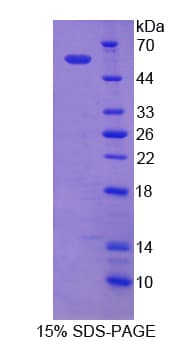Rat NCSTN / Nicastrin Protein (Recombinant His)