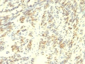 TGM2 / Transglutaminase 2 Antibody (clone TGM2/419)