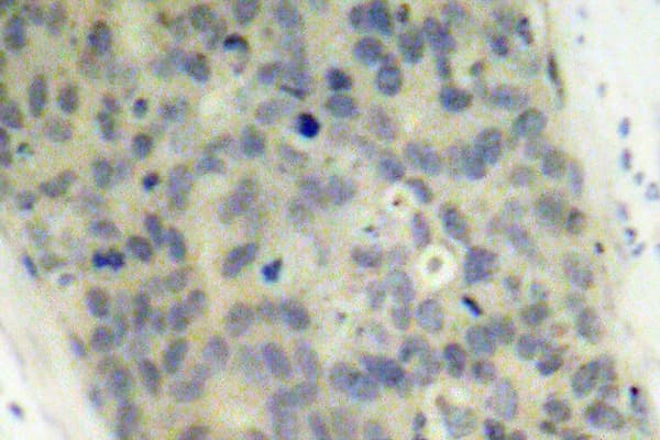 LIMK2 Antibody (phospho-Thr505)