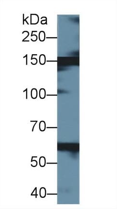 XDH / Xanthine Oxidase Antibody (aa2-219)
