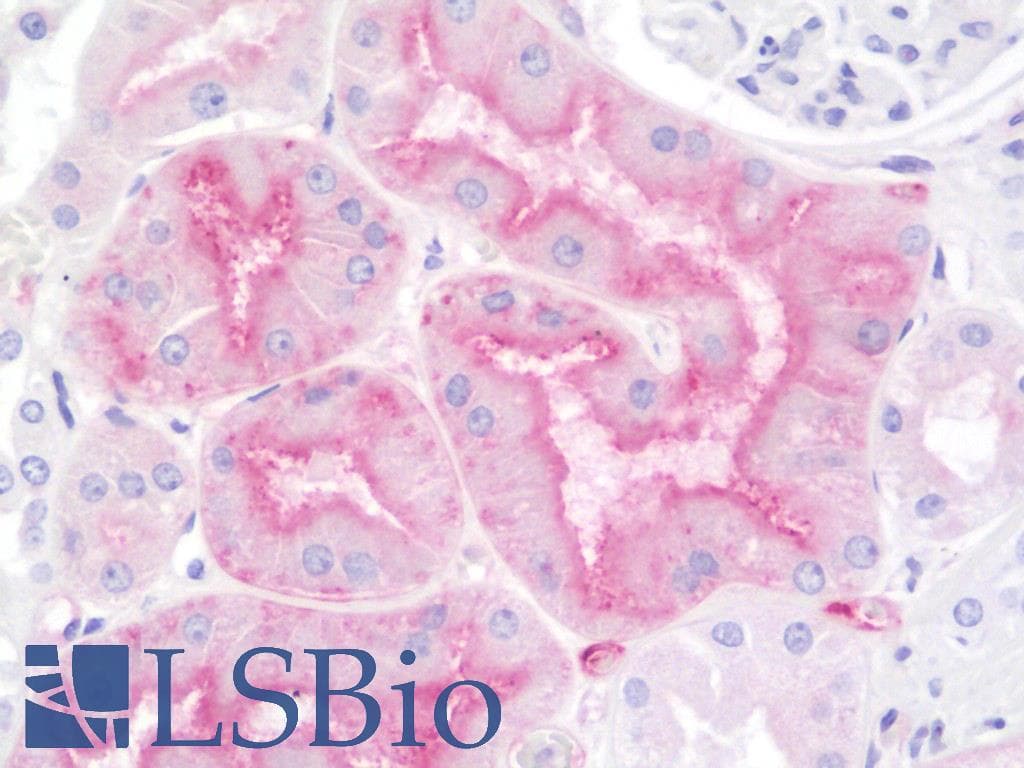 IHC-plus™ ALPL / Alkaline Phosphatase Antibody (aa1-359)