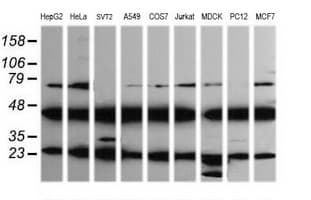 MAP2K1 / MKK1 / MEK1 Antibody (clone OTI4B1)