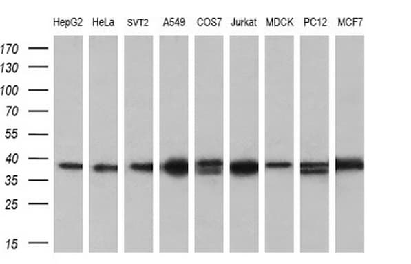 Monoclonal Mouse anti-Human ATG3 Antibody (clone OTI2C12, IHC, IF, WB)