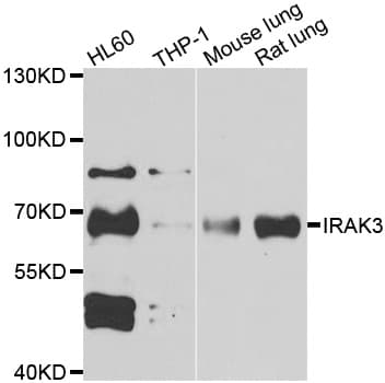IHC-plus™ IRAK3 / IRAKM / IRAK-M Antibody