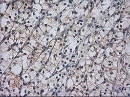 RASSF1 / RASSF1A Antibody (clone OTI2B11)